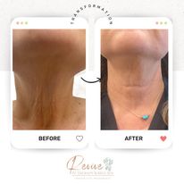 Revive IV Therapy & Med Spa - Business Photo Gallery Image