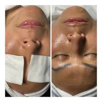 Maxfield Esthetics, LLC - Business Photo Gallery Image