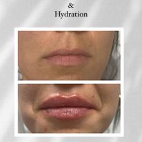 Bare Aesthetics and IV Hydration - Business Photo Gallery Image