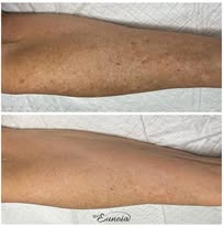 SPA Eunoia - Business Photo Gallery Image