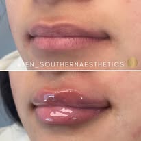 Southern Aesthetics - Business Photo Gallery Image
